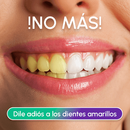 2X1 Lápiz Blanqueador Dental - DAZZLING WHITE + Envío GRATIS